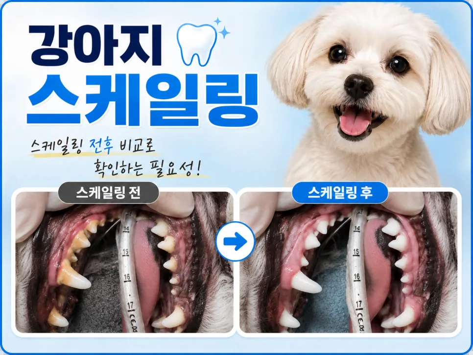 스케일링, 꼭 해야 할까요?